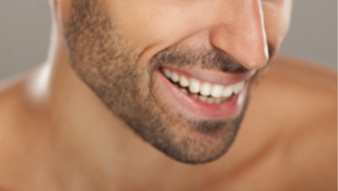 Trapianto barba e baffi